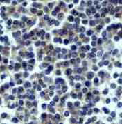 Immunohistochemistry (Formalin/PFA-fixed paraffin-embedded sections) - Anti-CD32B antibody [EP888Y] - BSA and Azide free (AB206217)