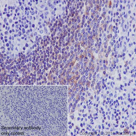 Immunohistochemistry (Formalin/PFA-fixed paraffin-embedded sections) - Anti-CD32B antibody [EP888Y] - BSA and Azide free (AB206217)
