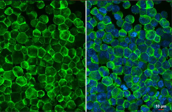 Immunocytochemistry/ Immunofluorescence - Anti-CD32B antibody [HL1948] (AB308210)