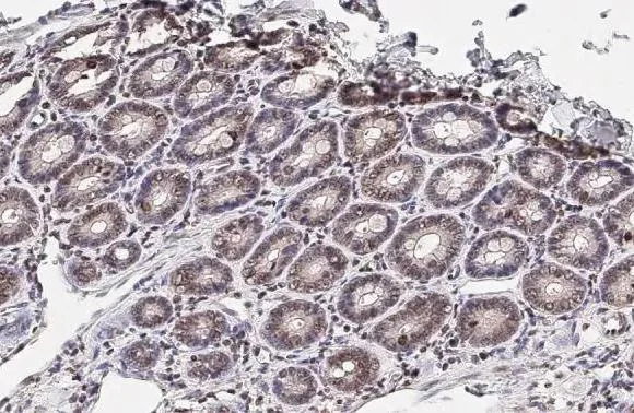 Immunohistochemistry (Formalin/PFA-fixed paraffin-embedded sections) - Anti-CD32B antibody [HL1948] (AB308210)
