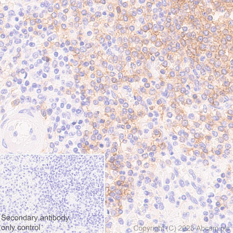 Immunohistochemistry (Formalin/PFA-fixed paraffin-embedded sections) - Anti-CD32B + CD32A + CD32C antibody [EP6243] (AB131051)