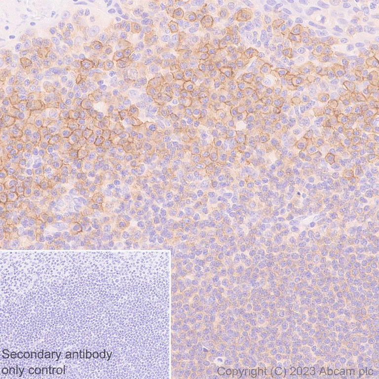Immunohistochemistry (Formalin/PFA-fixed paraffin-embedded sections) - Anti-CD32B + CD32A + CD32C antibody [EP6243] (AB131051)
