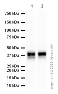 Western blot - Anti-CD32B + CD32A + CD32C antibody [EP6243] (AB131051)