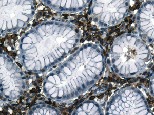 Immunohistochemistry (Formalin/PFA-fixed paraffin-embedded sections) - Anti-CD32B + CD32A + CD32C antibody [EPR6657(2)] (AB155972)