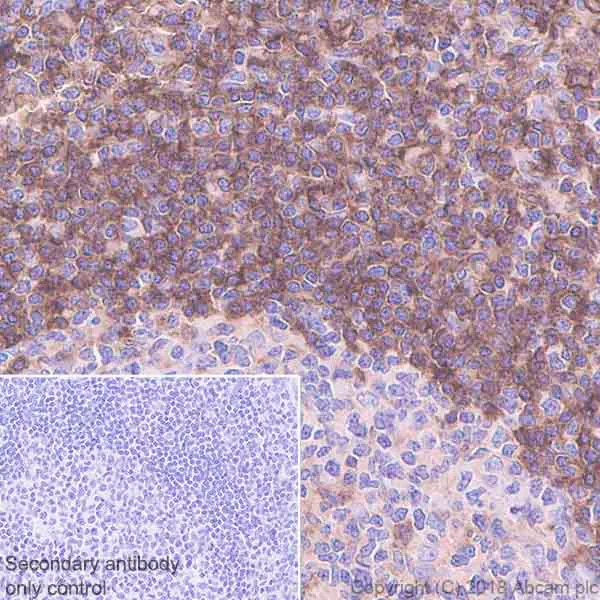 Immunohistochemistry (Formalin/PFA-fixed paraffin-embedded sections) - Anti-CD32B + CD32A + CD32C antibody [EPR6657(2)] - BSA and Azide free (AB222291)