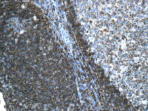 Immunohistochemistry (Formalin/PFA-fixed paraffin-embedded sections) - Anti-CD32B + CD32A + CD32C antibody [EPR6657(2)] - BSA and Azide free (AB222291)