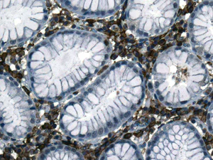 Immunohistochemistry (Formalin/PFA-fixed paraffin-embedded sections) - Anti-CD32B + CD32A + CD32C antibody [EPR6657(2)] - BSA and Azide free (AB222291)