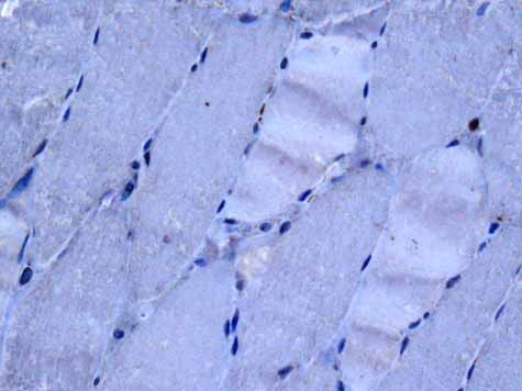 Immunohistochemistry (Formalin/PFA-fixed paraffin-embedded sections) - Anti-CD32B + CD32A + CD32C antibody [EPR6657(2)] - BSA and Azide free (AB222291)