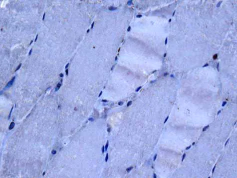 Immunohistochemistry (Formalin/PFA-fixed paraffin-embedded sections) - Anti-CD32B + CD32A + CD32C antibody [EPR6657(2)] - BSA and Azide free (AB222291)