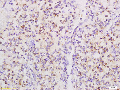 Immunohistochemistry (Formalin/PFA-fixed paraffin-embedded sections) - Anti-CD32B (phospho Y292) antibody (AB203877)