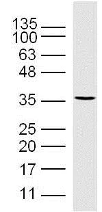 Western blot - Anti-CD32B (phospho Y292) antibody (AB203877)