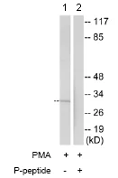 Western blot - Anti-CD32B (phospho Y292) antibody (AB74092)