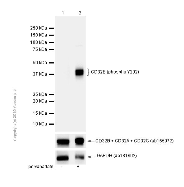 Western blot - Anti-CD32B (phospho Y292) antibody [EP926Y] (AB68423)