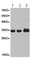 Western blot - Anti-CD33 antibody (AB194662), expandable thumbnail