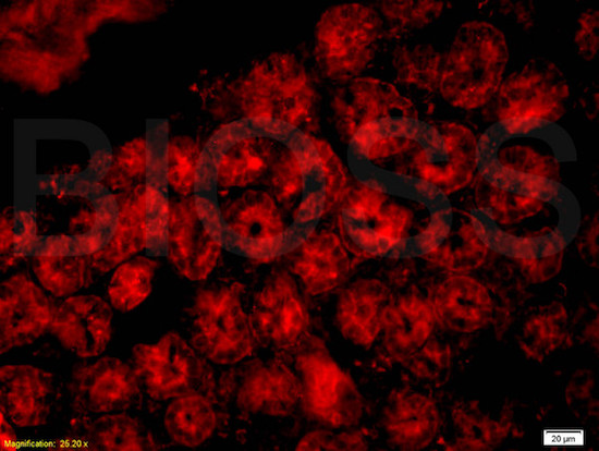 Immunohistochemistry (Formalin/PFA-fixed paraffin-embedded sections) - Anti-CD33 antibody (AB203032), expandable thumbnail