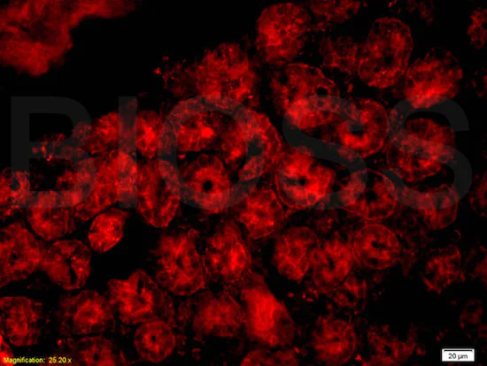 Immunohistochemistry (Formalin/PFA-fixed paraffin-embedded sections) - Anti-CD33 antibody (AB203032)