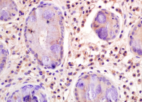 Immunohistochemistry (Formalin/PFA-fixed paraffin-embedded sections) - Anti-CD33 antibody (AB203253)