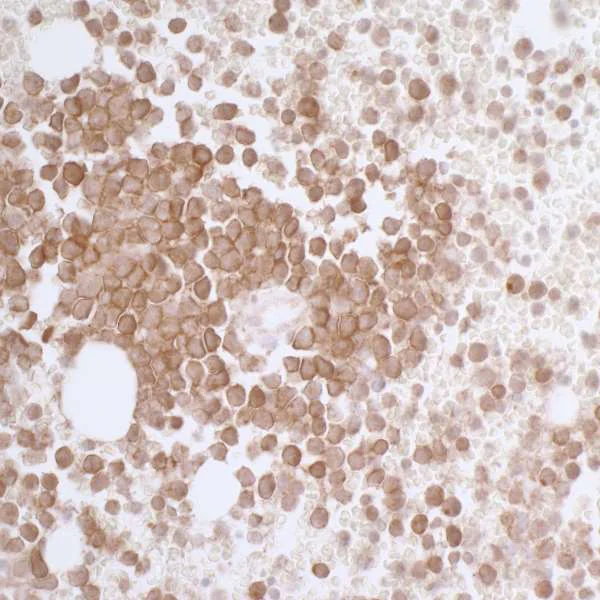 Immunohistochemistry (Formalin/PFA-fixed paraffin-embedded sections) - Anti-CD33 antibody [BLR061G] - BSA free (AB272082)