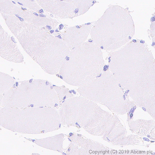 Immunohistochemistry (Formalin/PFA-fixed paraffin-embedded sections) - Anti-CD33 antibody [EPR23051-101] (AB269456)