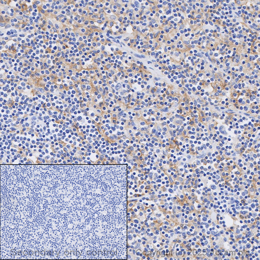 Immunohistochemistry (Formalin/PFA-fixed paraffin-embedded sections) - Anti-CD33 antibody [EPR23051-101] (AB269456)