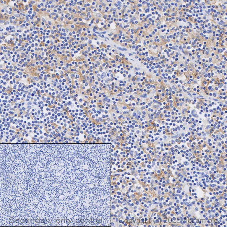 Immunohistochemistry (Formalin/PFA-fixed paraffin-embedded sections) - Anti-CD33 antibody [EPR23051-101] - BSA and Azide free (AB269461)