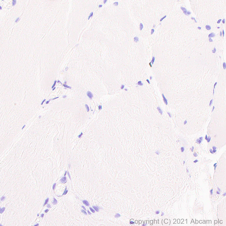 Immunohistochemistry (Formalin/PFA-fixed paraffin-embedded sections) - Anti-CD33 antibody [EPR24370-124] (AB270942)