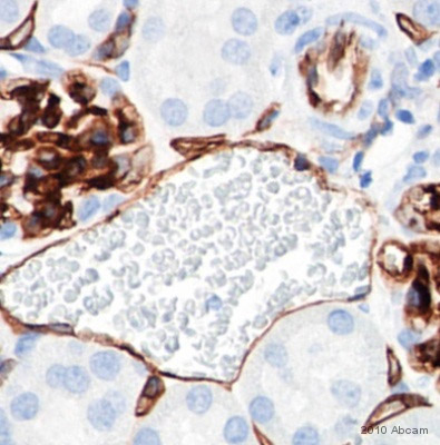 Immunohistochemistry (Formalin/PFA-fixed paraffin-embedded sections) - Anti-CD34 antibody (AB64480), expandable thumbnail