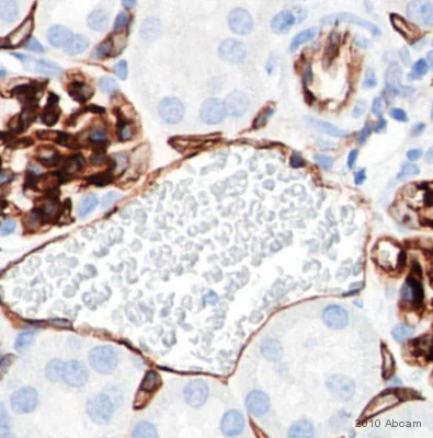 Immunohistochemistry (Formalin/PFA-fixed paraffin-embedded sections) - Anti-CD34 antibody (AB64480)