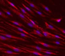 Immunocytochemistry/ Immunofluorescence - Anti-CD34 antibody [EP373Y] (ab81289), expandable thumbnail