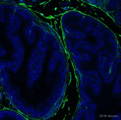Immunohistochemistry (Formalin/PFA-fixed paraffin-embedded sections) - Anti-CD34 antibody [EP373Y] - BSA and Azide free (AB198395)