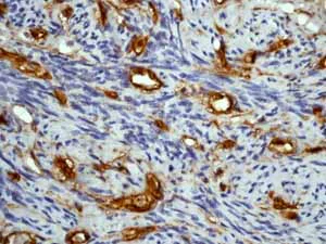 Immunohistochemistry (Formalin/PFA-fixed paraffin-embedded sections) - Anti-CD34 antibody [EP373Y] - BSA and Azide free (AB198395)