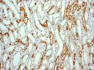 Immunohistochemistry (Formalin/PFA-fixed paraffin-embedded sections) - Anti-CD34 antibody [EP373Y] - BSA and Azide free (AB198395)