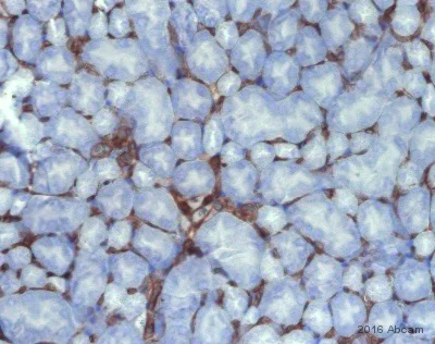 Immunohistochemistry (Formalin/PFA-fixed paraffin-embedded sections) - Anti-CD34 antibody [EP373Y] - BSA and Azide free (AB198395)