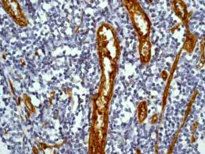 Immunohistochemistry (Formalin/PFA-fixed paraffin-embedded sections) - Anti-CD34 antibody [EP373Y] - BSA and Azide free (AB198395)
