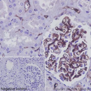 Immunohistochemistry (Formalin/PFA-fixed paraffin-embedded sections) - Anti-CD34 antibody [EP373Y] - BSA and Azide free (AB198395)