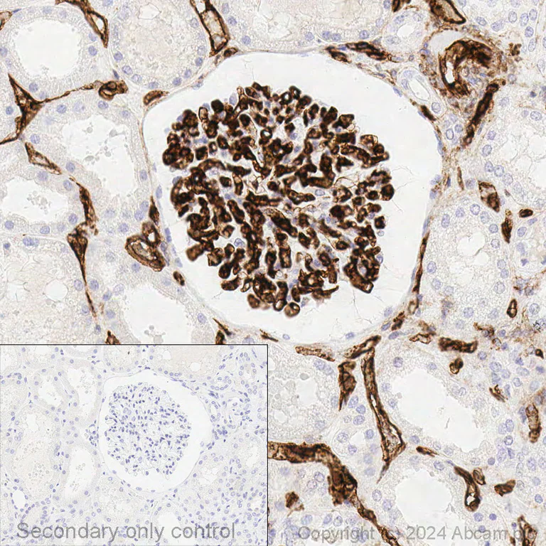 Immunohistochemistry (Formalin/PFA-fixed paraffin-embedded sections) - Anti-CD34 antibody [EP373Y] - BSA and Azide free (AB198395)