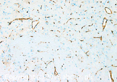 Immunohistochemistry (Formalin/PFA-fixed paraffin-embedded sections) - Anti-CD34 antibody [EP373Y] - BSA and Azide free (AB198395)