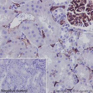 Immunohistochemistry (Formalin/PFA-fixed paraffin-embedded sections) - Anti-CD34 antibody [EP373Y] - BSA and Azide free (AB198395)