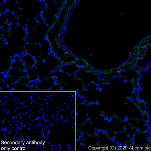 Immunohistochemistry (Frozen sections) - Anti-CD34 antibody [EP373Y] - BSA and Azide free (AB198395)