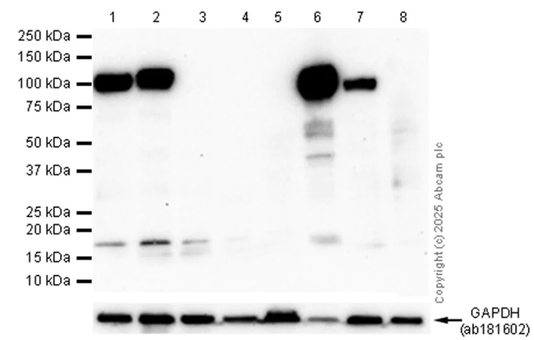 Western blot - Anti-CD34 antibody [EP373Y] - BSA and Azide free (AB198395)