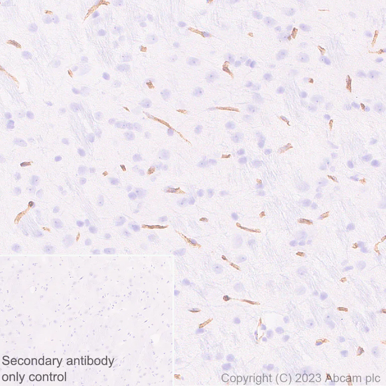 Immunohistochemistry (Formalin/PFA-fixed paraffin-embedded sections) - Anti-CD34 antibody [EPR27431-71] (AB316277)