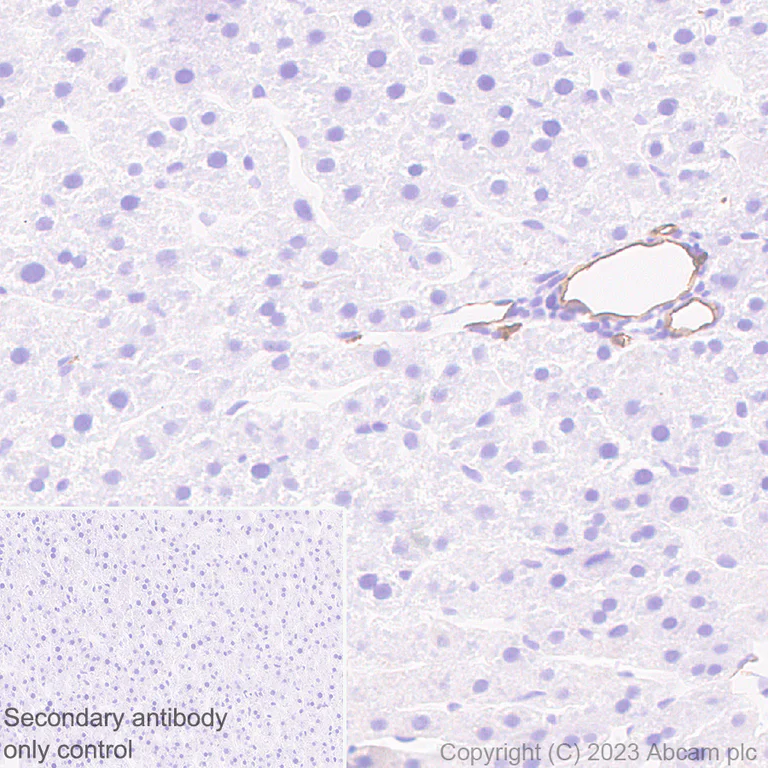 Immunohistochemistry (Formalin/PFA-fixed paraffin-embedded sections) - Anti-CD34 antibody [EPR27431-71] (AB316277)