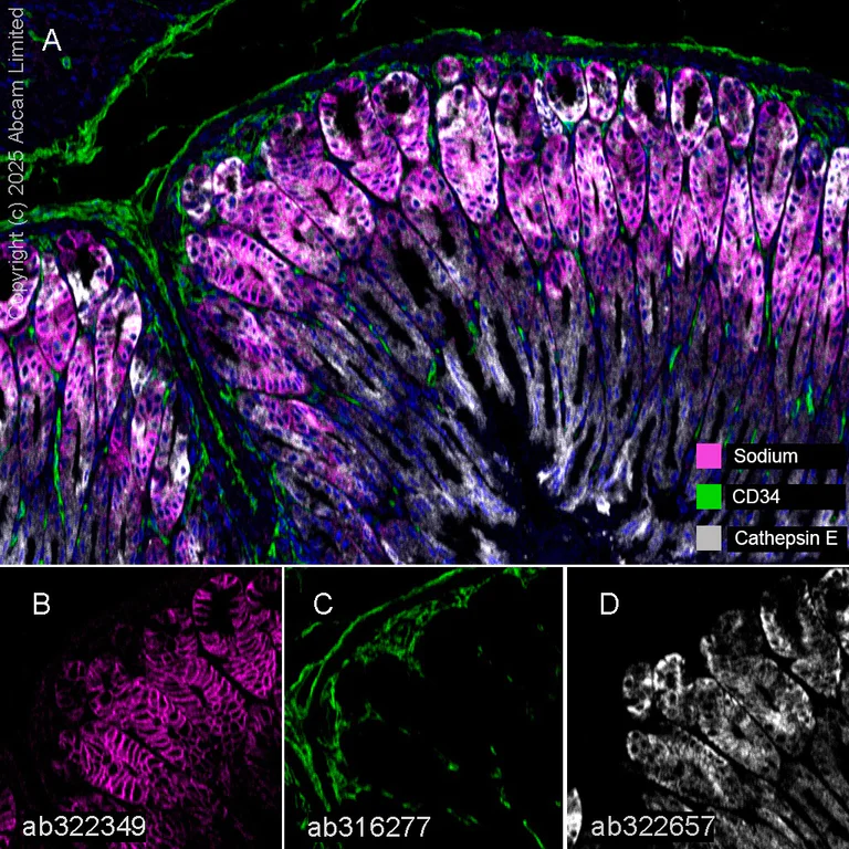 Multiplex immunohistochemistry - Anti-CD34 antibody [EPR27431-71] (AB316277)