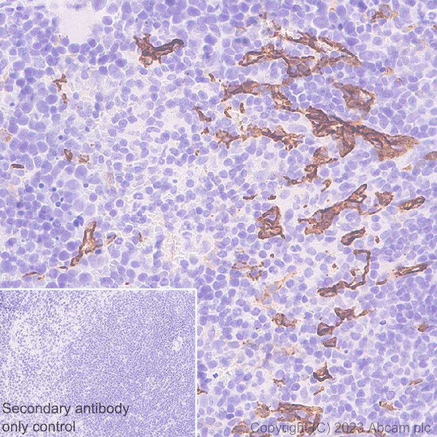 Immunohistochemistry (Formalin/PFA-fixed paraffin-embedded sections) - Anti-CD34 antibody [EPR27431-71] - BSA and Azide free (ab316278), expandable thumbnail
