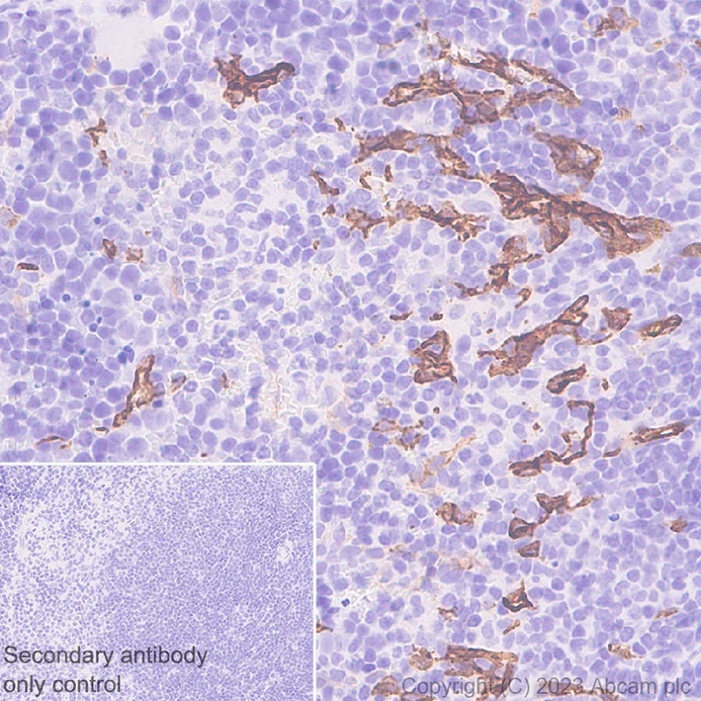 Immunohistochemistry (Formalin/PFA-fixed paraffin-embedded sections) - Anti-CD34 antibody [EPR27431-71] - BSA and Azide free (AB316278)