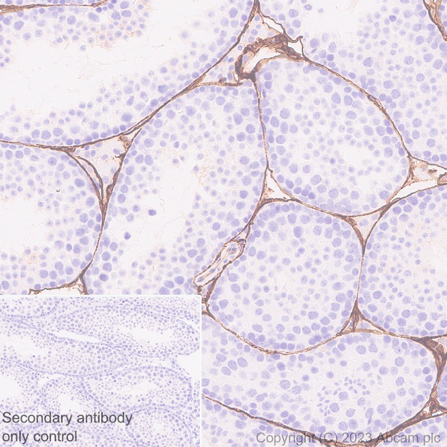 Immunohistochemistry (Formalin/PFA-fixed paraffin-embedded sections) - Anti-CD34 antibody [EPR27431-71] - BSA and Azide free (ab316278), expandable thumbnail