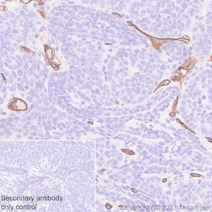 Immunohistochemistry (Formalin/PFA-fixed paraffin-embedded sections) - Anti-CD34 antibody [EPR27431-71] - BSA and Azide free (ab316278), expandable thumbnail