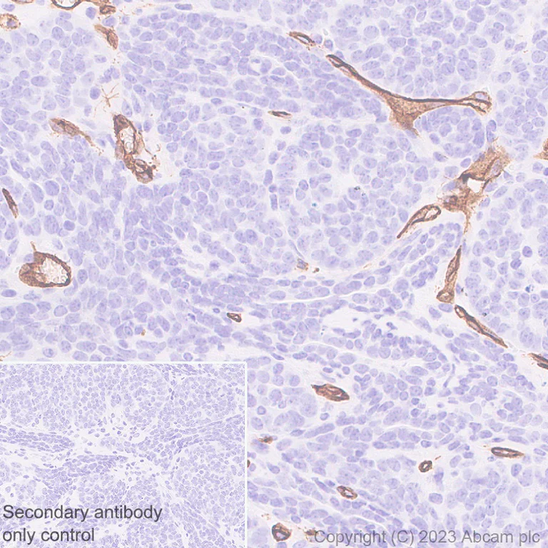 Immunohistochemistry (Formalin/PFA-fixed paraffin-embedded sections) - Anti-CD34 antibody [EPR27431-71] - BSA and Azide free (AB316278)