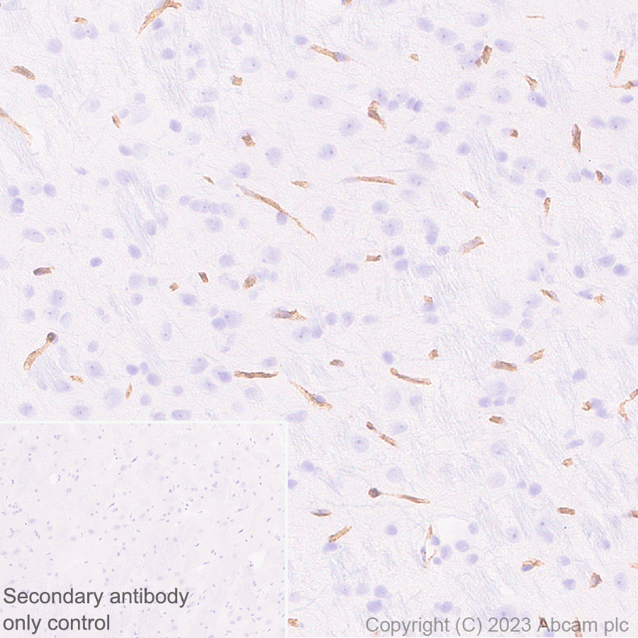 Immunohistochemistry (Formalin/PFA-fixed paraffin-embedded sections) - Anti-CD34 antibody [EPR27431-71] - BSA and Azide free (ab316278), expandable thumbnail