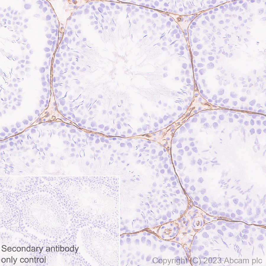 Immunohistochemistry (Formalin/PFA-fixed paraffin-embedded sections) - Anti-CD34 antibody [EPR27431-71] - BSA and Azide free (ab316278), expandable thumbnail